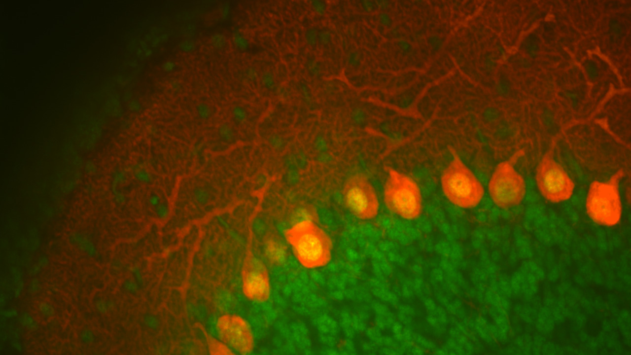 väikeaju närviirakud