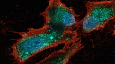 Munasarjas leiduvate folliikuli rakkude mudel mikroskoobist nähtuna